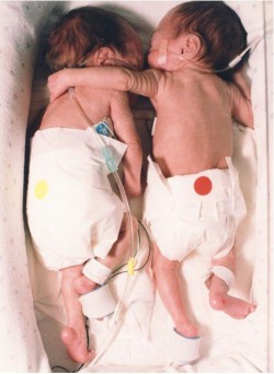 coldest-dreams:jaidefinichon:  La foto es de un artículo llamado “El Abrazo Salvador”. El artículo detalla la primera semana de vida de una pareja de gemelos. Cada uno estaba en sus respectivas incubadoras y uno no se esperaba que sobreviviera.