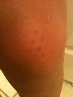 You can&rsquo;t really tell, but I have little bruises from the barricade. And I was only on it for like four songs. Jeebus.