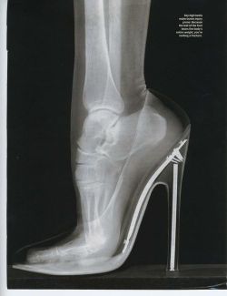 stardustkr7:  misocorny:  That’s why it fucking hurts  Someone please show this to those fucking dudebros who want women to wear heels all the time instead of flats/flip flops…. 