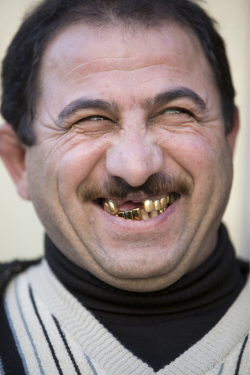 Golden Teeth After the collapse of the Soviet Union, the citizens of Azerbaijan had doubts about economic stability. Many Azeris decided that the safest place to put their money was their mouth. © Ph: Newsha Tavakolian