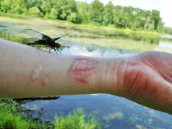 sqrtnegativeone:  sqrtnegativeone:  So basically this dragonfly was beautiful, but he had a broken wing. He crawled around my arm and I fell a bit in love with this.  Still in love with this photo. Also with the fact that those scars just look like white