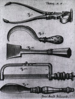 sutured-infection:  Jonas Arnold Delineavit - Amputation Instruments, from Johannes Scultetus’s Armamentarium chirurgicum bipartitum, 1666 