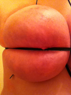 clipsnpins:  Close up.  And another marvelous self-abused breast from the tumblr breast bondage star of the hour&hellip;